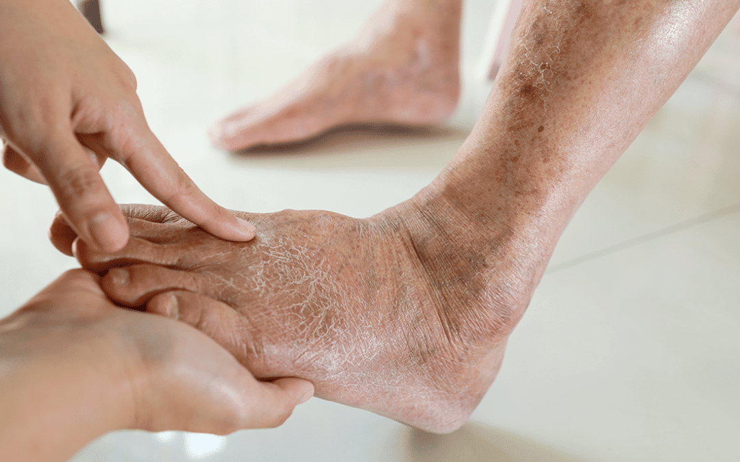 Comprehensive Foot Care: A Guide for Seniors and Caregivers